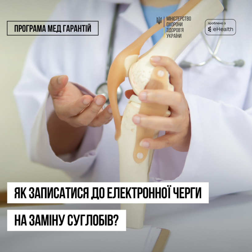 Фото ілюстративне: зображено медичного працівника в білому халаті, який тримає анатомічну модель колінного суглоба. На фоні видно стетоскоп, що підкреслює професійну медичну тематику.